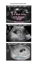 Fake Ultrasound 4-6 Week Twins With Arrows