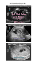 4-6 week twins with arrows strip ultrasound in 3 different pictures