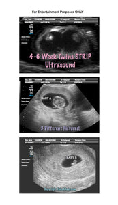 Fake Ultrasound 4-6 Week Twins