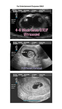 4-6 week twins strip ultrasound in 3 different pictures