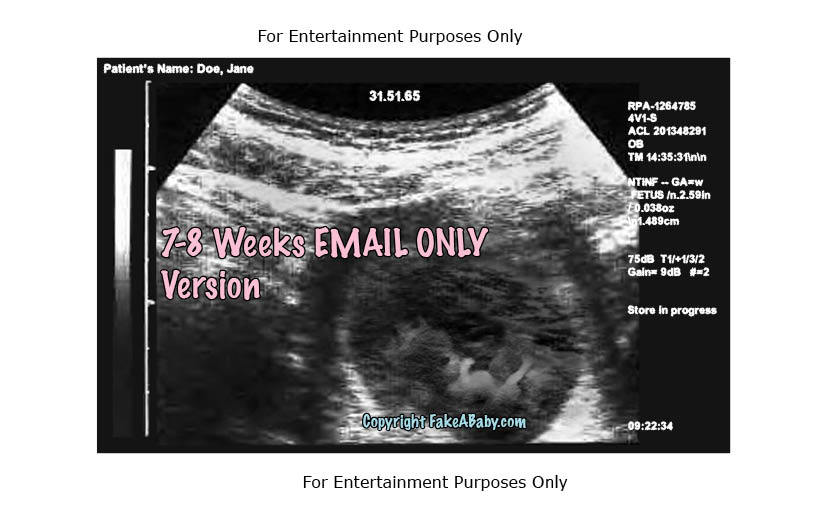 7-8 weeks 2D fake ultrasound