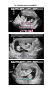 Fake Ultrasound 7-8 Week Twins