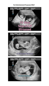 7-8 week twins with arrows strip ultrasound in 3 different pictures