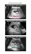 Fake Ultrasound 7-8 Week
