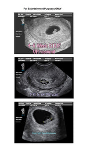 Fake Ultrasound 4-6 Week