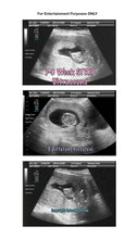 7-8 weeks strip ultrasound in 3 different pictures