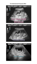 9-10 weeks strip ultrasound in 3 different pictures