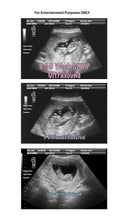 9-10 week twins with arrows strip ultrasound in 3 different pictures