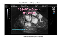 10-14 Week Triplets Ultrasound Fake Sonogram
