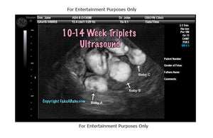 10-14 Week Triplets Ultrasound Fake Sonogram