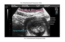 11-12 Week Ultrasound Fake Sonogram