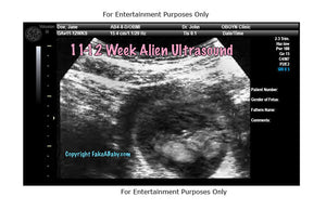 11-12 Week Alien Head Ultrasound Fake Sonogram