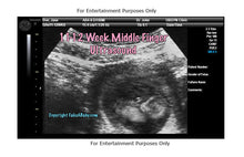 11-12 Week Middle Finger Ultrasound Fake Sonogram