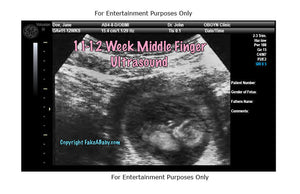 11-12 Week With Middle Finger Fake Sonogram