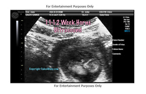 11-12 Week Horns Ultrasound Fake Sonogram