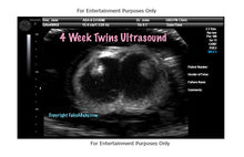 4 Week Twins Ultrasound Fake Sonogram