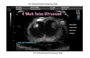 4 Week Twins Ultrasound Fake Sonogram