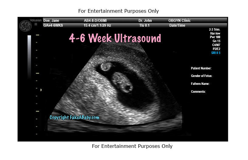 4-6 Week Ultrasound Fake Sonogram