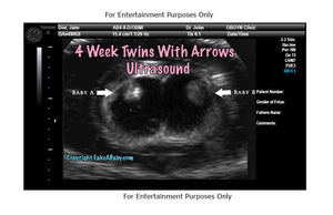 4 Week Twins With Arrows Ultrasound Fake Sonogram