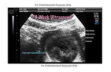 7-8 Week Ultrasound Fake Sonogram