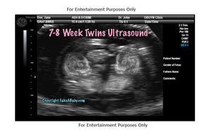 7-8 Week Twins Ultrasound Fake Sonogram