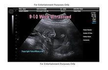 9-10 Week Ultrasound Fake Sonogram