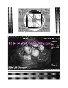 2D Fake Ultrasound 10 to 14 Week Triplets