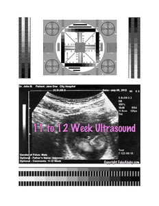 2D Fake Ultrasound 11 to 12 Weeks