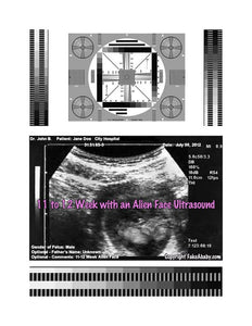 2D Fake Ultrasound 11 to 12 Week Alien