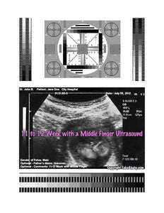 2D Fake Ultrasound 11 to 12 Weeks with Middle Finger