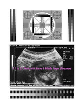 2D Fake Ultrasound 11 to 12 Weeks with Middle Finger & Horns