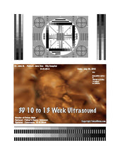 3D 10 to 13 week ultrasound