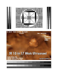 3D 10 to 17 week ultrasound