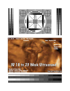 3D 18 to 23 week ultrasound