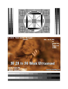 3D 28 to 36 week ultrasound
