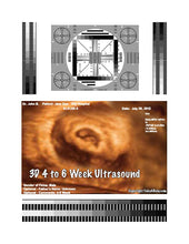 3D 4 to 6 week ultrasound