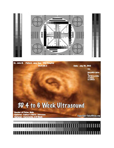 3D 4 to 6 week ultrasound