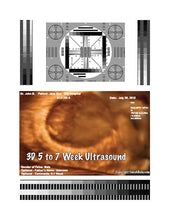 3D 5 to 7 week ultrasound