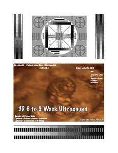 3D 6 to 9 week ultrasound