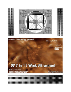 3D 7 to 11 week ultrasound
