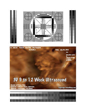 3D 9 to 12 week ultrasound