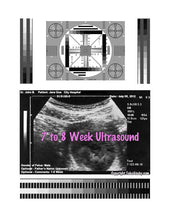 2D Fake Ultrasound 7 to 8 Weeks
