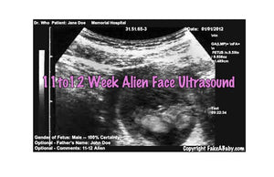 11 to 12 week alien face ultrasound