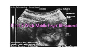 11 to 12 week middle finger ultrasound