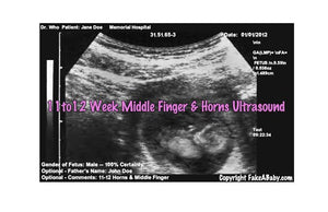 11 to 12 week middle finger & horns ultrasound