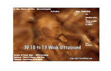 3D 10-13 Weeks Ultrasound