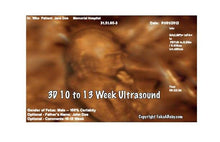 3D 10 to 13 week ultrasound