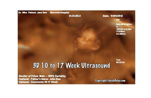 3D 10 to 17 week ultrasound