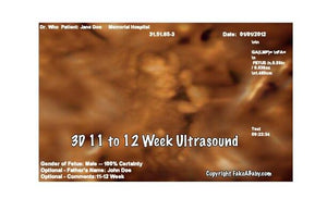 3D 11 to 12 week ultrasound