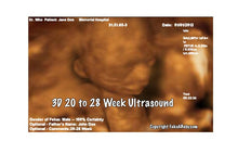 3D 20 to 28 Weeks Ultrasound